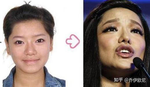 邓紫棋整容前照片,揭秘明星蜕变之路